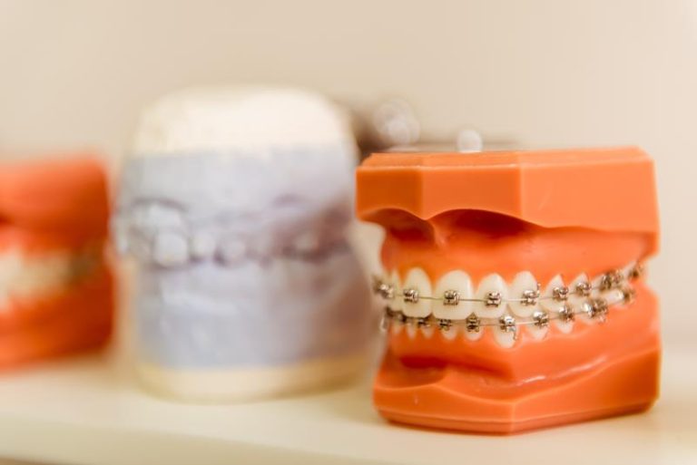 Orthodontic Services in Flossmoor, Frankfort, & Plainfield IL All